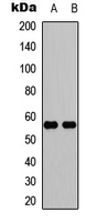 Western blot analysis of IFIT5 expression in Jurkat (A); mouse lung (B) whole cell lysates.