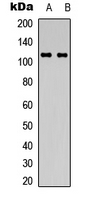 Western blot analysis of CD49c expression in A549 (A); A431 (B) whole cell lysates.