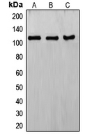 Western blot analysis of ERCC4 expression in HeLa (A); KNRK (B); MCF7 (C) whole cell lysates.
