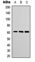 Western blot analysis of POTEH expression in COLO205 (A); mouse spleen (B); mouse heart (C) whole cell lysates.