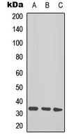 Western blot analysis of TAL1/2 (AcK221+222/K36+37) expression in Jurkat (A); mouse heart (B); mouse brain (C) whole cell lysates.