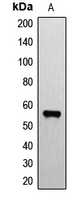 Western blot analysis of ETV1 expression in mouse brain (A) whole cell lysates.