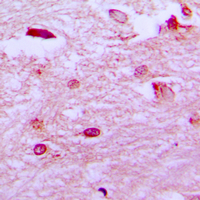 Immunohistochemical analysis of ETV1 staining in human brain formalin fixed paraffin embedded tissue section. The section was pre-treated using heat mediated antigen retrieval with sodium citrate buffer (pH 6.0). The section was then incubated with the antibody at room temperature and detected using an HRP conjugated compact polymer system. DAB was used as the chromogen. The section was then counterstained with haematoxylin and mounted with DPX.