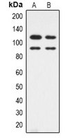 Western blot analysis of CDK11B expression in HepG2 (A); Hela (B) whole cell lysates.