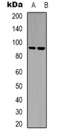 Western blot analysis of LTK expression in Raji (A); Jurkat (B) whole cell lysates.