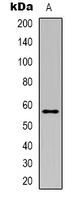 Western blot analysis of Clipin A expression in Jurkat (A) whole cell lysates.