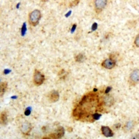 Immunohistochemical analysis of Clipin A staining in human brain formalin fixed paraffin embedded tissue section. The section was pre-treated using heat mediated antigen retrieval with sodium citrate buffer (pH 6.0). The section was then incubated with the antibody at room temperature and detected using an HRP conjugad compact polymer system. DAB was used as the chromogen. The section was then counterstained with haematoxylin and mounted with DPX.