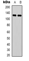 Western blot analysis of C/EBP zeta expression in H460 (A); COLO205 (B) whole cell lysates.