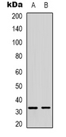 Western blot analysis of FOXE3 expression in SHSYSY (A); MDAMB435 (B) whole cell lysates.