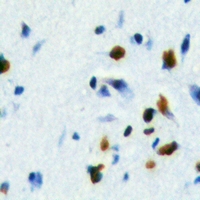 Immunohistochemical analysis of FOXE3 staining in human brain formalin fixed paraffin embedded tissue section. The section was pre-treated using heat mediated antigen retrieval with sodium citrate buffer (pH 6.0). The section was then incubated with the antibody at room temperature and detected using an HRP conjugacompact polymer system. DAB was used as the chromogen. The section was then counterstained with haematoxylin and mounted with DPX.