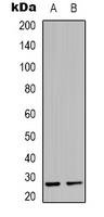 Western blot analysis of MOB3C expression in K562 (A); mouse heart (B) whole cell lysates.