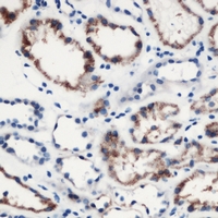 Immunohistochemical analysis of MOB3C staining in human kidney formalin fixed paraffin embedded tissue section. The section was pre-treated using heat mediated antigen retrieval with sodium citrate buffer (pH 6.0). The section was then incubated with the antibody at room temperature and detected using an HRP conjugacompact polymer system. DAB was used as the chromogen. The section was then counterstained with haematoxylin and mounted with DPX.