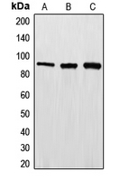 Western blot analysis of EWS expression in HepG2 (A); Jurkat (B); HeLa (C) whole cell lysates.