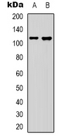 Western blot analysis of Collagen 19 alpha 1 expression in Hela (A); HepG2 (B) whole cell lysates.