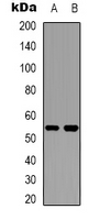 Western blot analysis of Cytochrome P450 2W1 expression in Hela (A); HepG2 (B) whole cell lysates.