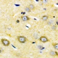 Immunohistochemical analysis of Cytochrome P450 2W1 staining in human brain formalin fixed paraffin embedded tissue section. The section was pre-treated using heat mediated antigen retrieval with sodium citrate buffer (pH 6.0). The section was then incubated with the antibody at room temperature and detected using an HRP conjugacompact polymer system. DAB was used as the chromogen. The section was then counterstained with haematoxylin and mounted with DPX.