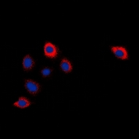 Immunofluorescent analysis of Cytochrome P450 2W1 staining in Hela cells. Formalin-fixed cells were permeabilized with 0.1% Triton X-100 in TBS for 5-10 minutes and blocked with 3% BSA-PBS for 30 minutes at room temperature. Cells were probed with the primary antibody in 3% BSA-PBS and incubated overnight at 4 deg C in a hidified chamber. Cells were washed with PBST and incubated with a DyLight 594-conjugated secondary antibody (red) in PBS at room temperature in the dark. DAPI was used to stain the cell nuclei (blue).