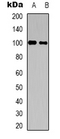 Western blot analysis of CNTROB expression in HepG2 (A); HUVEC (B) whole cell lysates.