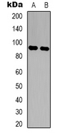 Western blot analysis of LONP2 expression in RT4 (A); K562 (B) whole cell lysates.