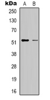Western blot analysis of RSAD1 expression in HepG2 (A); Hela (B) whole cell lysates.