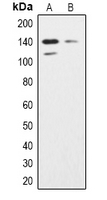 Western blot analysis of SHIP2 expression in K562 (A); Hela (B) whole cell lysates.
