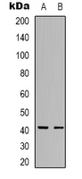 Western blot analysis of GPR10 expression in A2058 (A); Jurkat (B) whole cell lysates.