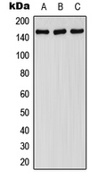 Western blot analysis of FANCA (pS1149) expression in HepG2 EGF-treated (A); SP2/0 EGF-treated (B); H9C2 EGF-treated (C) whole cell lysates.