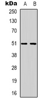 Western blot analysis of GPCR135 expression in SKNSH (A); K562 (B) whole cell lysates.