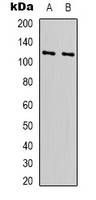Western blot analysis of RPS6KC1 expression in Hela (A); HEK293T (B) whole cell lysates.