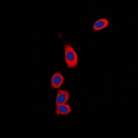 Immunofluorescent analysis of RPS6KC1 staining in Hela cells. Formalin-fixed cells were permeabilized with 0.1% Triton X-100 in TBS for 5-10 minutes and blocked with 3% BSA-PBS for 30 minutes at room temperature. Cells were probed with the primary antibody in 3% BSA-PBS and incubated overnight at 4 deg C in a hidified chamber. Cells were washed with PBST and incubated with a DyLight 594-conjugated secondary antibody (red) in PBS at room temperature in the dark. DAPI was used to stain the cell nuclei (blue).