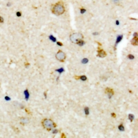 Immunohistochemical analysis of CEP135 staining in human brain formalin fixed paraffin embedded tissue section. The section was pre-treated using heat mediated antigen retrieval with sodium citrate buffer (pH 6.0). The section was then incubated with the antibody at room temperature and detected using an HRP conjugacompact polymer system. DAB was used as the chromogen. The section was then counterstained with haematoxylin and mounted with DPX.
