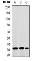 Western blot analysis of GPR40 expression in K562 (A); mouse kidney (B); COS7 (C) whole cell lysates.