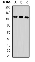 Western blot analysis of COP1 (pS387) expression in Jurkat UV-treated (A); 293 UV-treated (B); K562 UV-treated (C) whole cell lysates.