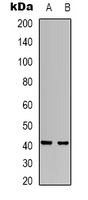 Western blot analysis of RRS1 expression in Hela (A); SHSY5Y (B) whole cell lysates.