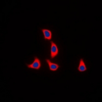 Immunofluorescent analysis of WASF1 (pY125) staining in K562 cells. Formalin-fixed cells were permeabilized with 0.1% Triton X-100 in TBS for 5-10 minutes and blocked with 3% BSA-PBS for 30 minutes at room temperature. Cells were probed with the primary antibody in 3% BSA-PBS and incubated overnight at 4 deg C in a hidified chamber. Cells were washed with PBST and incubated with a DyLight 594-conjugated secondary antibody (red) in PBS at room temperature in the dark. DAPI was used to stain the cell nuclei (blue).