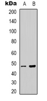Western blot analysis of PSKH1 expression in Hela (A); HepG2 (B) whole cell lysates.