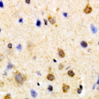 Immunohistochemical analysis of PSKH1 staining in human brain formalin fixed paraffin embedded tissue section. The section was pre-treated using heat mediated antigen retrieval with sodium citrate buffer (pH 6.0). The section was then incubated with the antibody at room temperature and detected using an HRP conjugacompact polymer system. DAB was used as the chromogen. The section was then counterstained with haematoxylin and mounted with DPX.