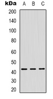Western blot analysis of ZNF24 expression in Hela (A); Jurkat (B); HUVEC (C) whole cell lysates.