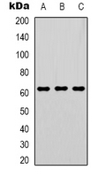 Western blot analysis of GTF2H1 expression in Hela (A); Jurkat (B); PC3 (C) whole cell lysates.