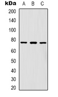 Western blot analysis of FOXK1 expression in Hela (A); A431 (B); Jurkat (C) whole cell lysates.