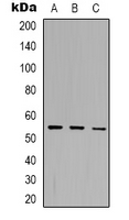 Western blot analysis of DOK7 expression in Jurkat (A); K562 (B); mouse brain (C) whole cell lysates.