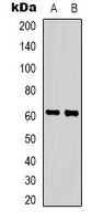 Western blot analysis of ZNF397 expression in HepG2 (A); Hela (B) whole cell lysates.