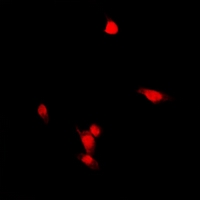 Immunofluorescent analysis of ZNF397 staining in HepG2 cells. Formalin-fixed cells were permeabilized with 0.1% Triton X-100 in TBS for 5-10 minutes and blocked with 3% BSA-PBS for 30 minutes at room temperature. Cells were probed with the primary antibody in 3% BSA-PBS and incubated overnight at 4 deg C in a hidified chamber. Cells were washed with PBST and incubated with a DyLight 594-conjugated secondary antibody (red) in PBS at room temperature in the dark. DAPI was used to stain the cell nuclei (blue).
