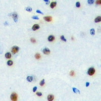 Immunohistochemical analysis of ZNF785 staining in human brain formalin fixed paraffin embedded tissue section. The section was pre-treated using heat mediated antigen retrieval with sodium citrate buffer (pH 6.0). The section was then incubated with the antibody at room temperature and detected using an HRP conjugacompact polymer system. DAB was used as the chromogen. The section was then counterstained with haematoxylin and mounted with DPX.