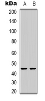 Western blot analysis of BTBD6 expression in HepG2 (A); MCF7 (B) whole cell lysates.