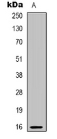 Western blot analysis of PBOV1 expression in human prostate (A) whole cell lysates.