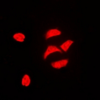 Immunofluorescent analysis of PBOV1 staining in HeLa cells. Formalin-fixed cells were permeabilized with 0.1% Triton X-100 in TBS for 5-10 minutes and blocked with 3% BSA-PBS for 30 minutes at room temperature. Cells were probed with the primary antibody in 3% BSA-PBS and incubated overnight at 4 deg C in a hidified chamber. Cells were washed with PBST and incubated with a DyLight 594-conjugated secondary antibody (red) in PBS at room temperature in the dark. DAPI was used to stain the cell nuclei (blue).