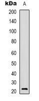 Western blot analysis of BCA3 expression in A549 (A) whole cell lysates.