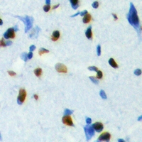 Immunohistochemical analysis of TCFL5 staining in human brain formalin fixed paraffin embedded tissue section. The section was pre-treated using heat mediated antigen retrieval with sodium citrate buffer (pH 6.0). The section was then incubated with the antibody at room temperature and detected using an HRP conjugacompact polymer system. DAB was used as the chromogen. The section was then counterstained with haematoxylin and mounted with DPX.