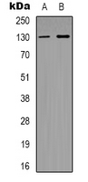 Western blot analysis of SUR2 expression in Hela (A); MCF7 (B) whole cell lysates.
